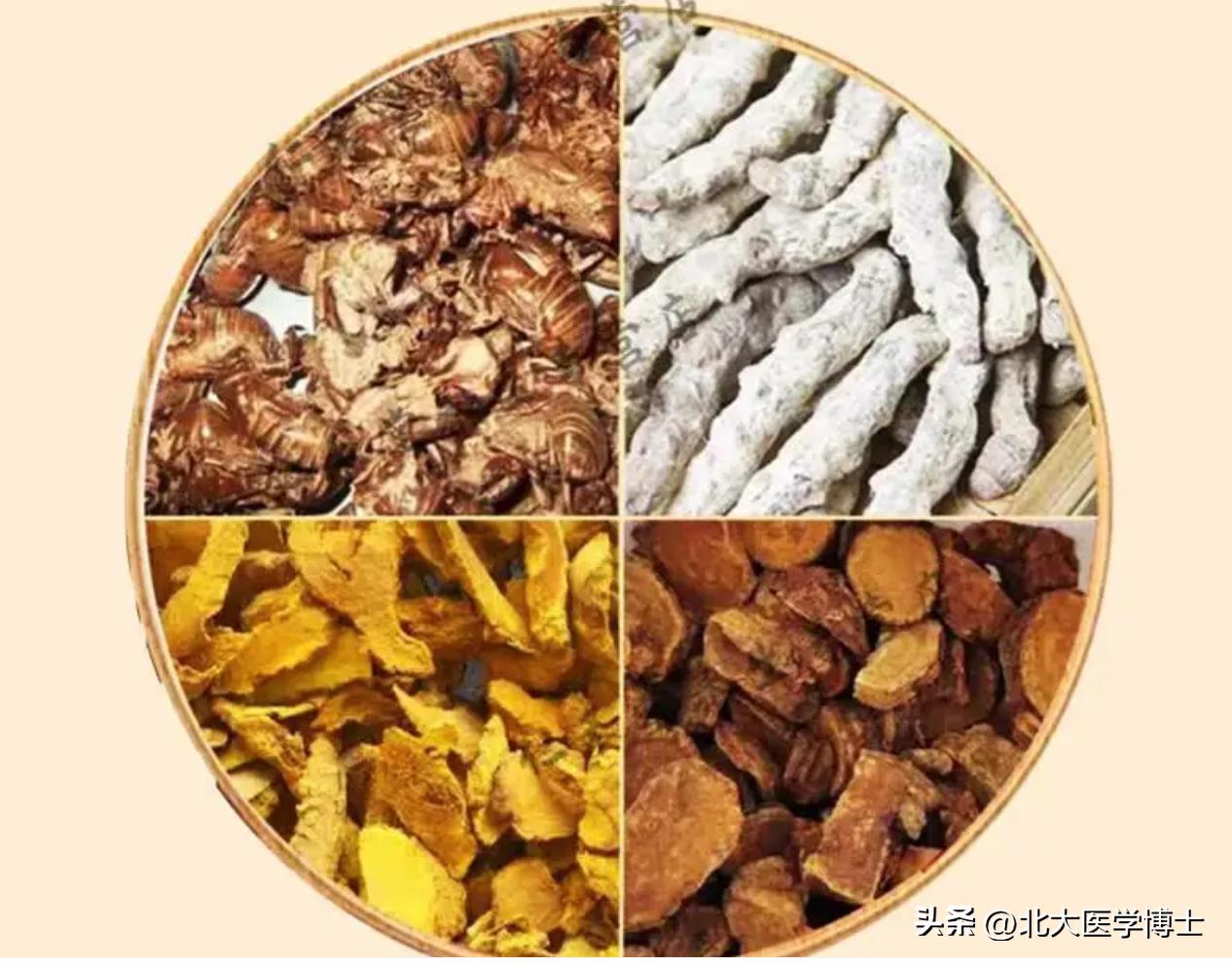 清阳不升经方治疗,肾结石中医排石治疗方案