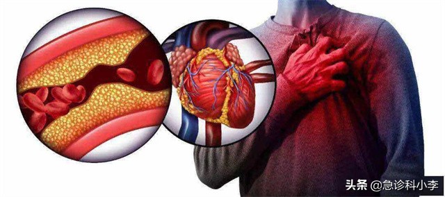 医生血脂化验单,医生一步一步教您看血脂化验单