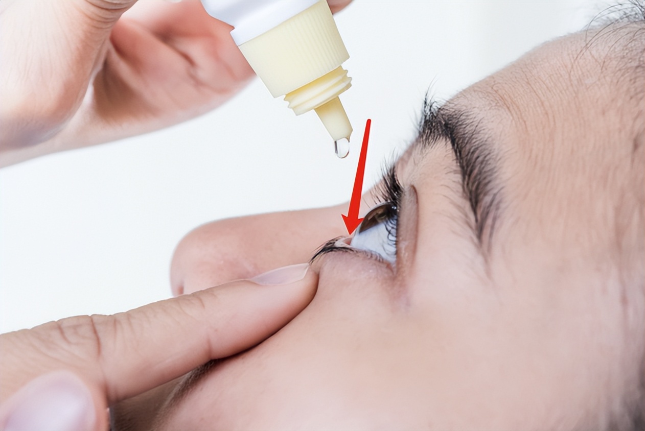 眼睛有红血丝用什么眼药水最佳,眼睛涩红血丝怎么办