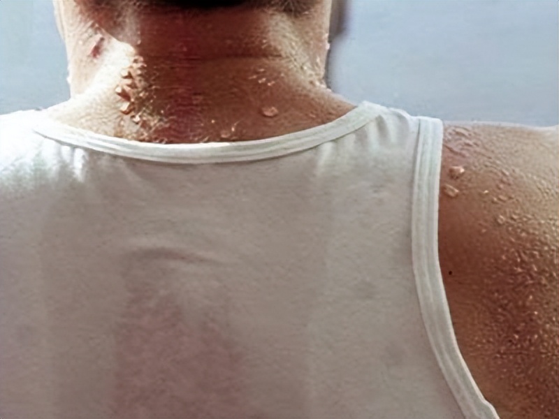 气虚自汗和阴虚盗汗有什么区别,阴虚盗汗和表虚自汗有什么差别