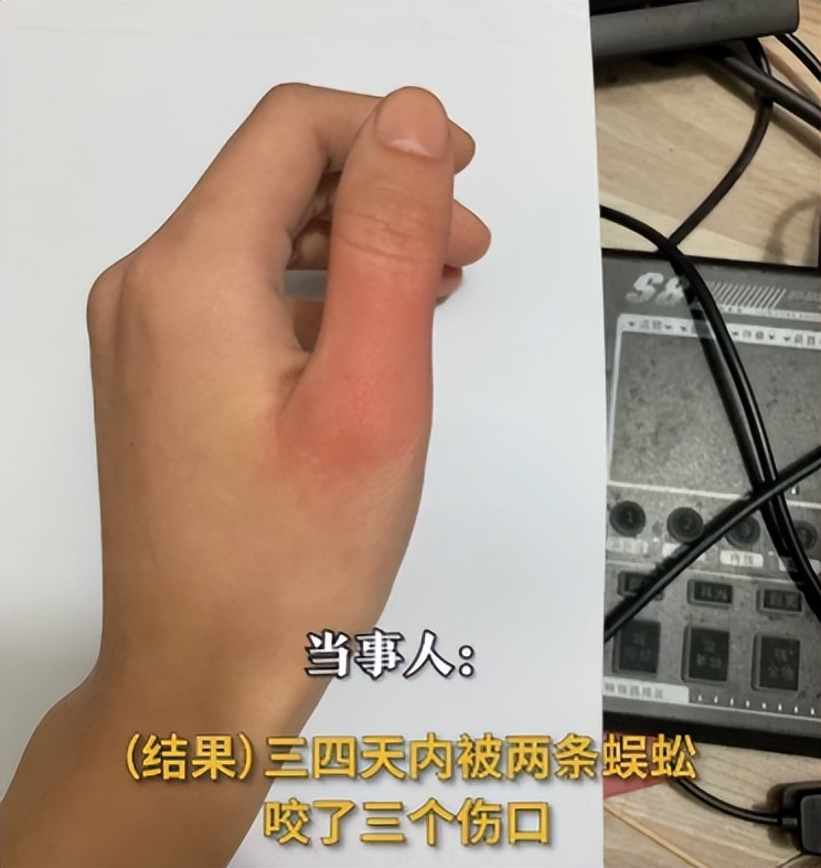 女子睡觉被蜈蚣咬伤,蜈蚣究竟有多恐怖,蛇真的打不过蜈蚣吗?