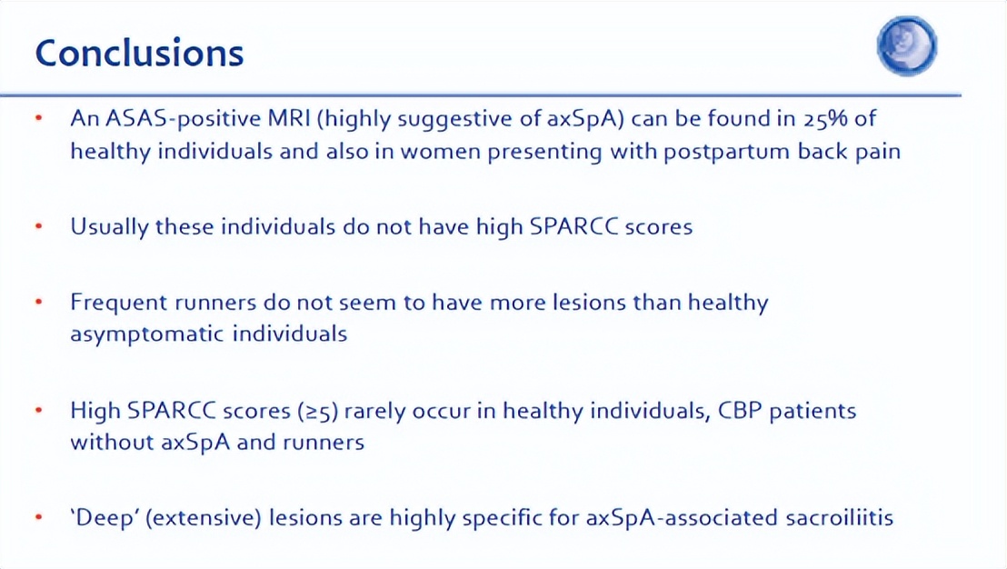 骶髂关节骨髓水肿最好的治疗方案,骶髂关节水肿是强直性脊柱炎吗