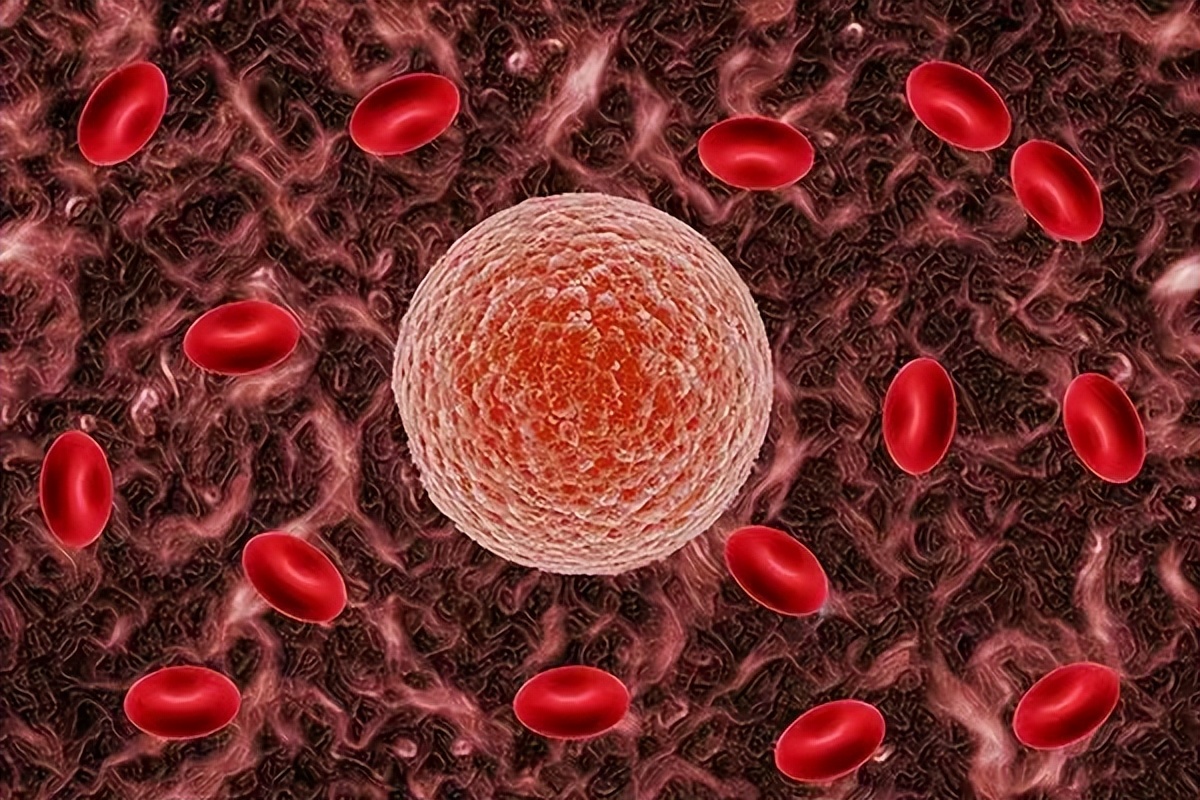 缠腰龙致命吗,皮肤病缠腰龙