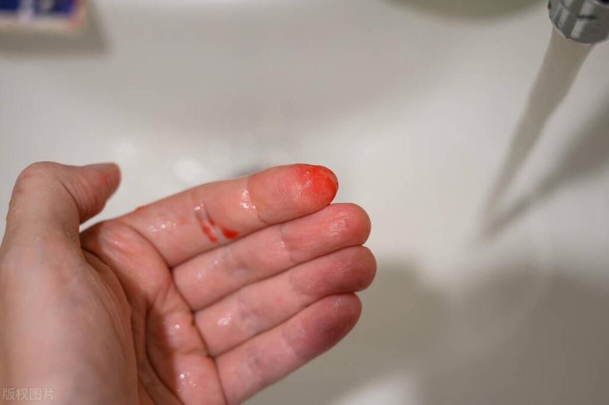 癌中之王胰腺癌有多可怕,癌中之王胰腺癌怎么缓解