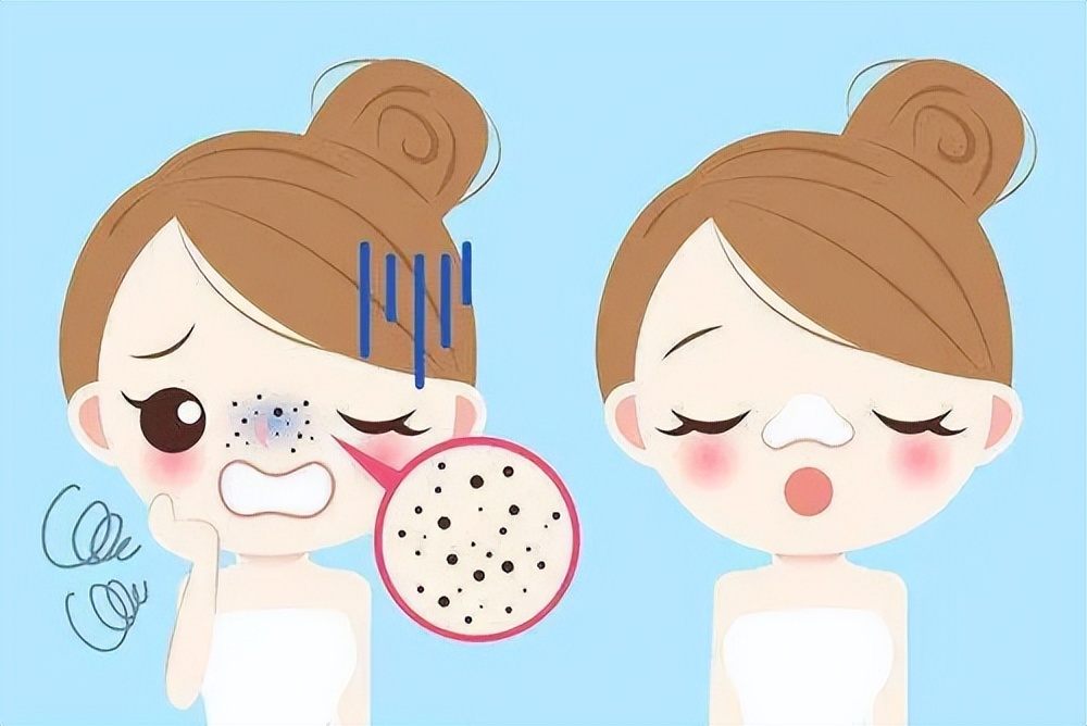 如何可以真正的解决毛孔问题,不同肤质该怎样清洁毛孔