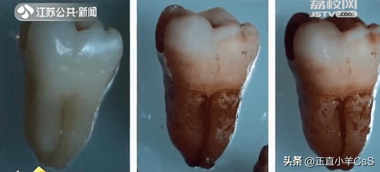 广西37岁孕妇,37岁广西孕妇