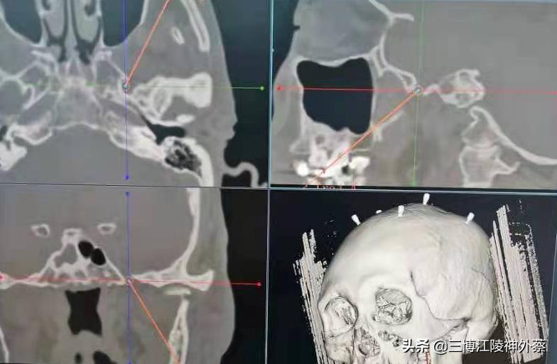 无缘无故面部疼痛怎么解决,面部有时感觉疼是什么原因