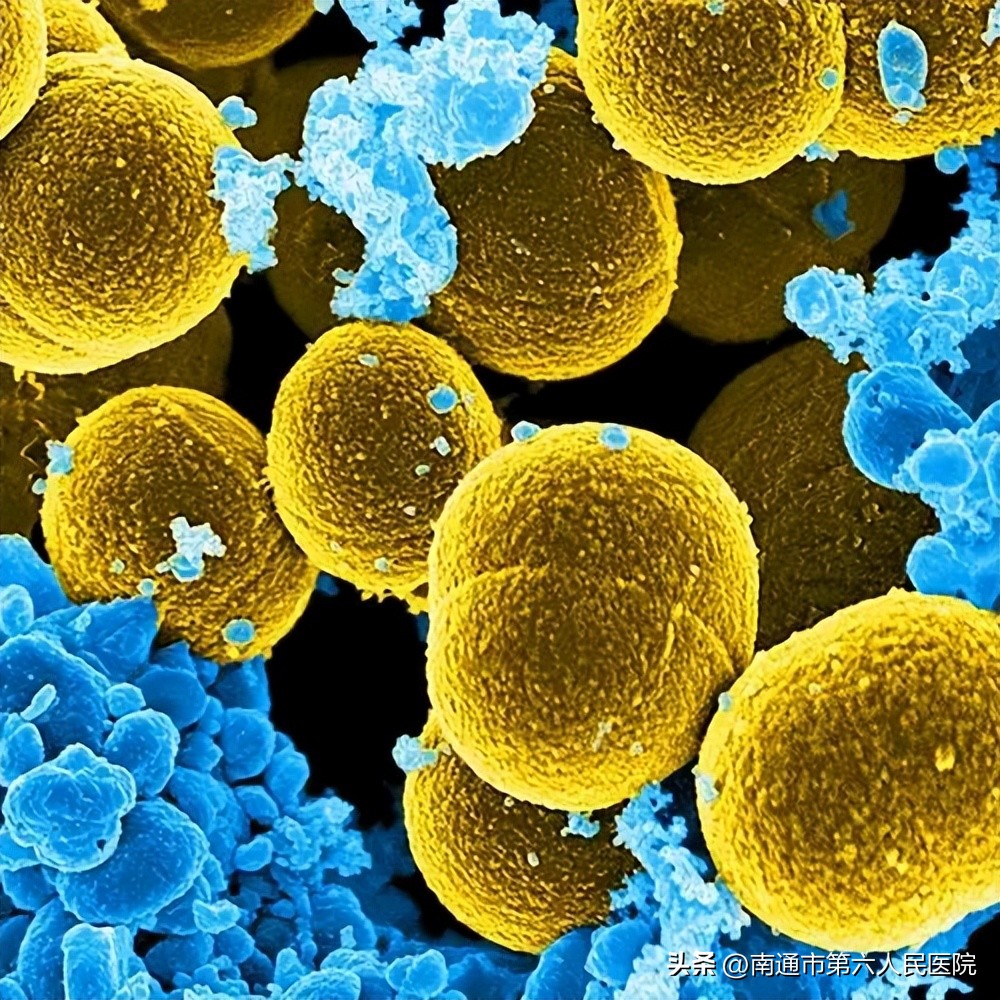 “偷针眼”？你还在用头发丝或棕丝这种土方子吗？