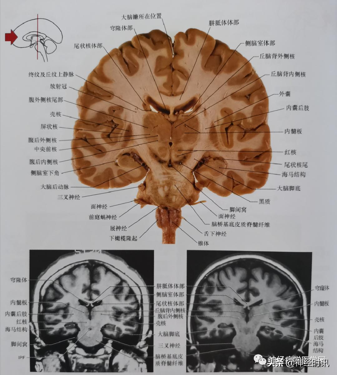 ct袖珍断层解剖图谱最新版,头颅ct断层解剖图谱无水印