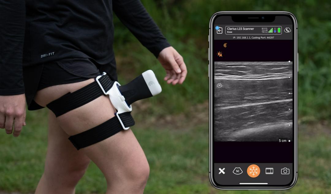 破多项纪录,首个可穿戴超声来了