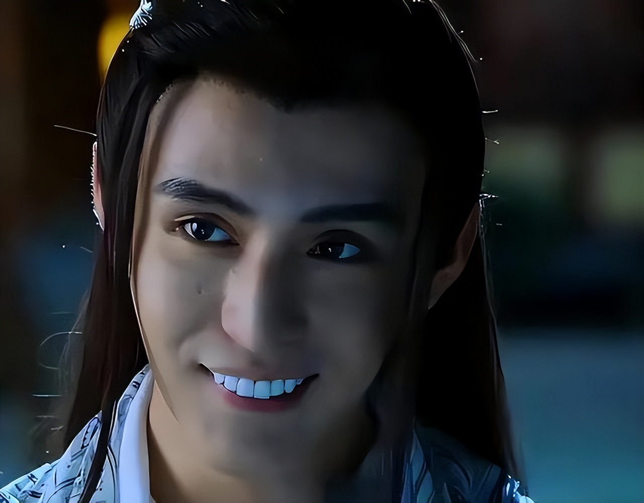 烤瓷牙牙龈发黑的明星,娱乐圈真的都是烤瓷牙吗