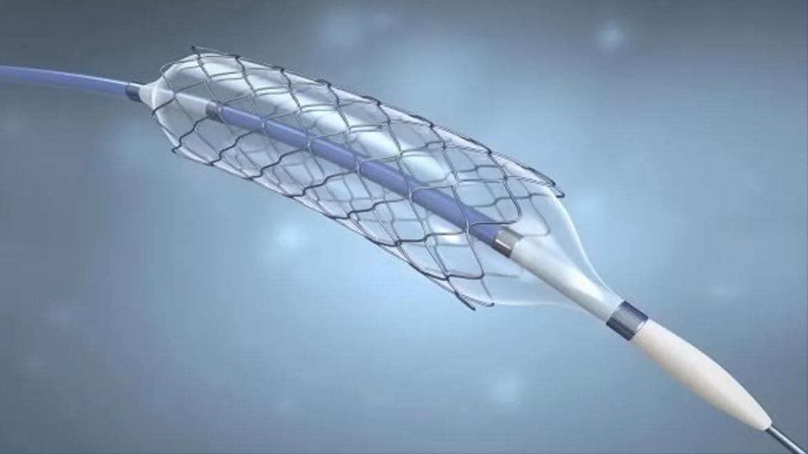 心脏支架手术做了还会堵,还有必要做吗?做与不做取决于这一点