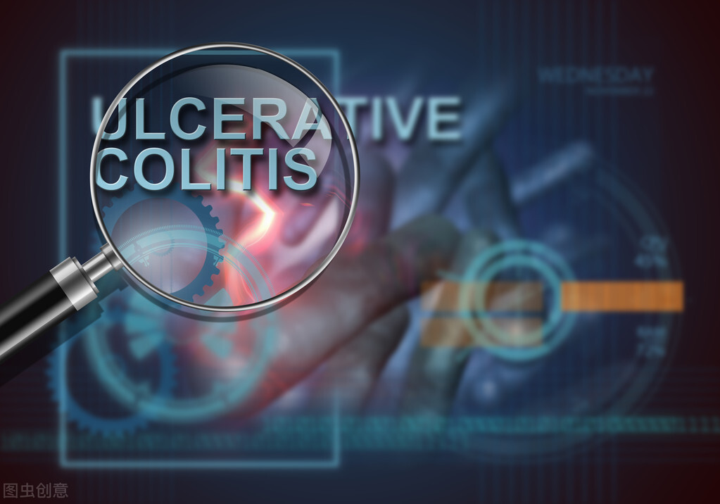 溃疡性结肠炎的科普,溃疡性结肠炎营养支持指南