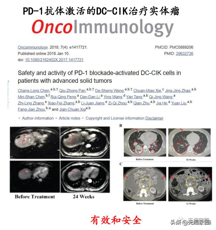 细胞免疫疗法治疗癌症,细胞免疫疗法能治愈癌症吗
