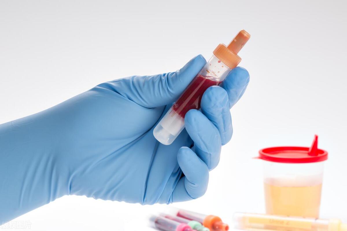 直肠癌晚期可能会有哪些临床表现?