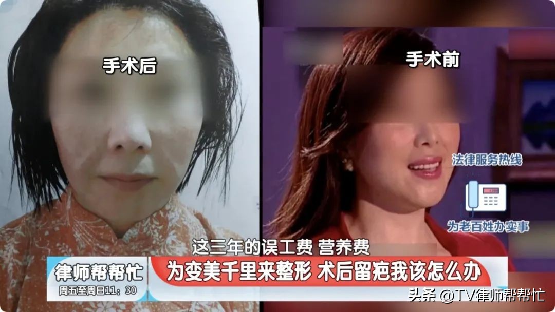 为了变美去整容最后倒在了手术台,为了变美却做了隆胸手术