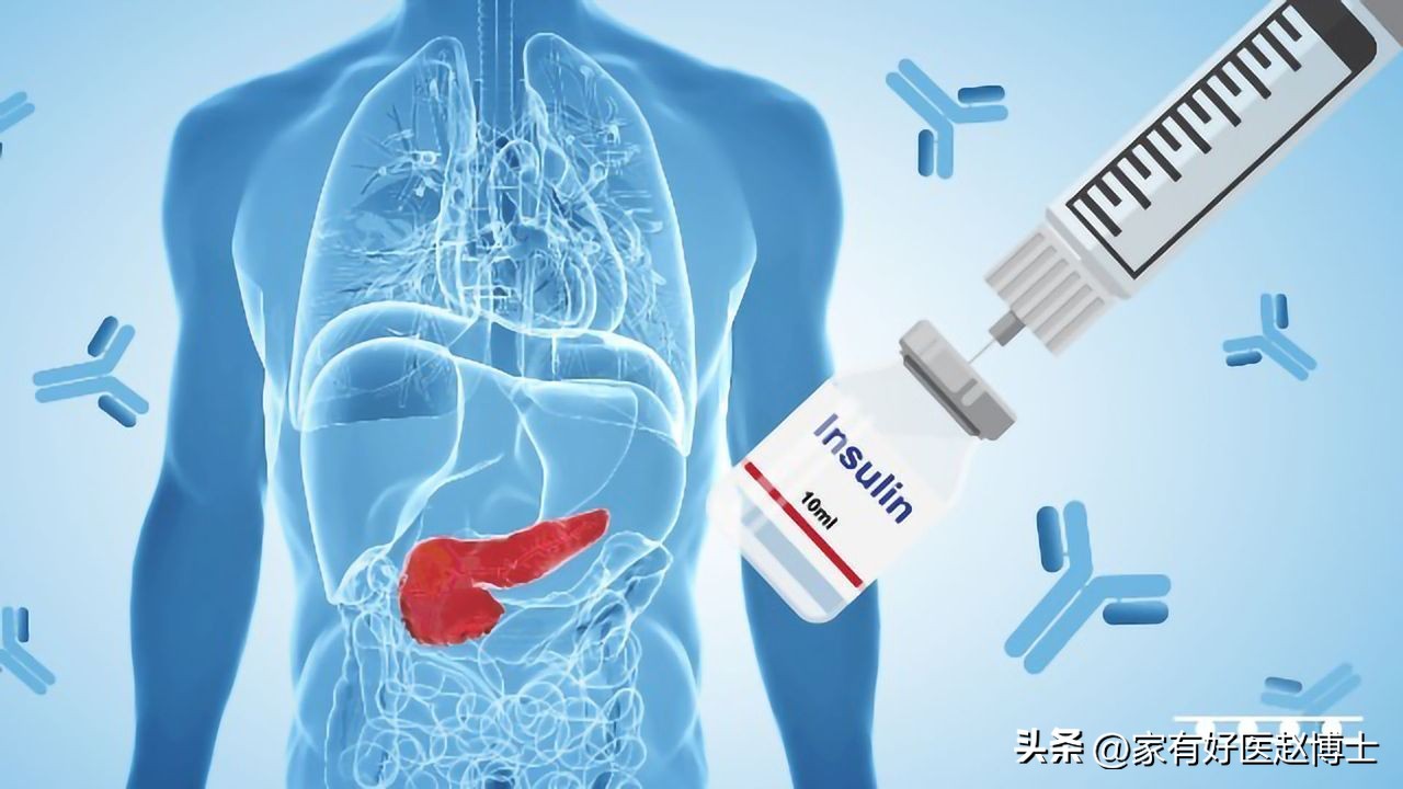 “缓解/逆转”2型糖尿病，具体有三种方法！适用的情况各不相同