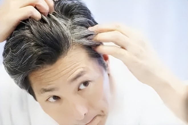 年少白了头说明什么,年少轻狂要注意什么