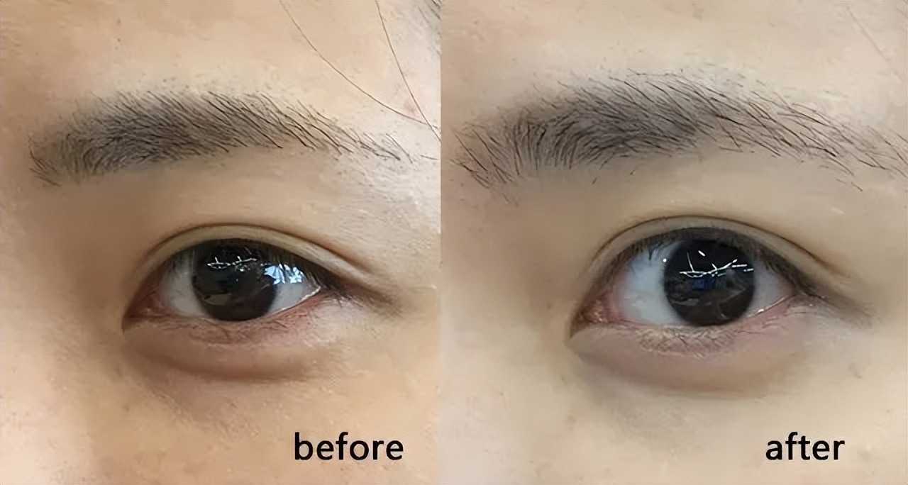 海蓝之谜活颜焕肤精华油,海蓝之谜lamer璀璨焕活精华油30ml