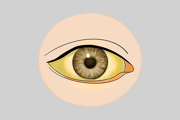 中医气虚则肥血虚则瘦是什么意思,胖是气虚瘦是血虚这句话对吗