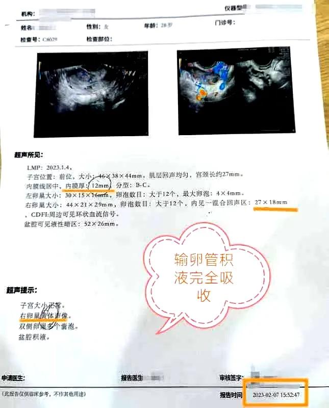 女科医话|庞震苗教授中药治疗输卵管积液型不孕一例