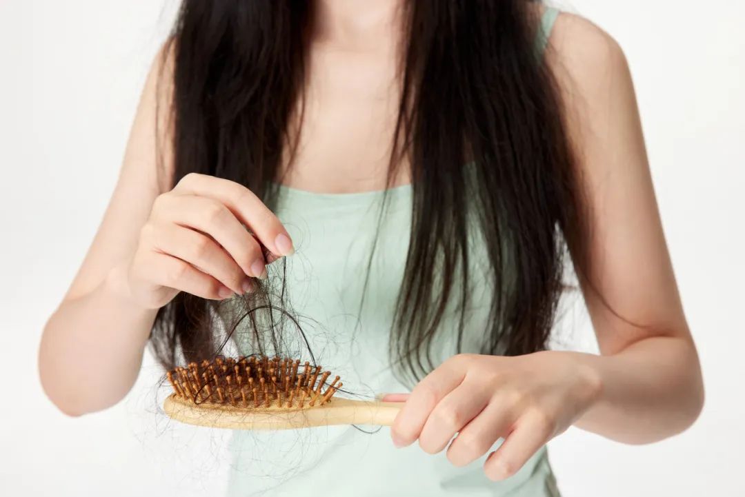 最近脱发脱得厉害是什么原因,怎么防止秃头脱发最有效的方法