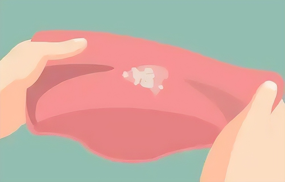 *处私**痒痒有异味,可能是因为......90%的女性不了解!