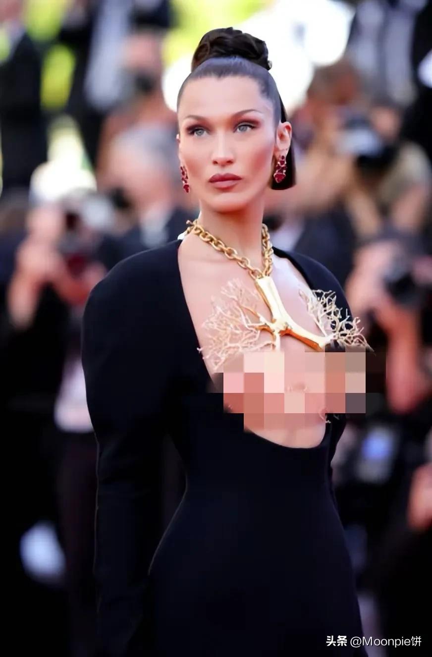 为什么胼胝体会缺失,schiaparelli水平