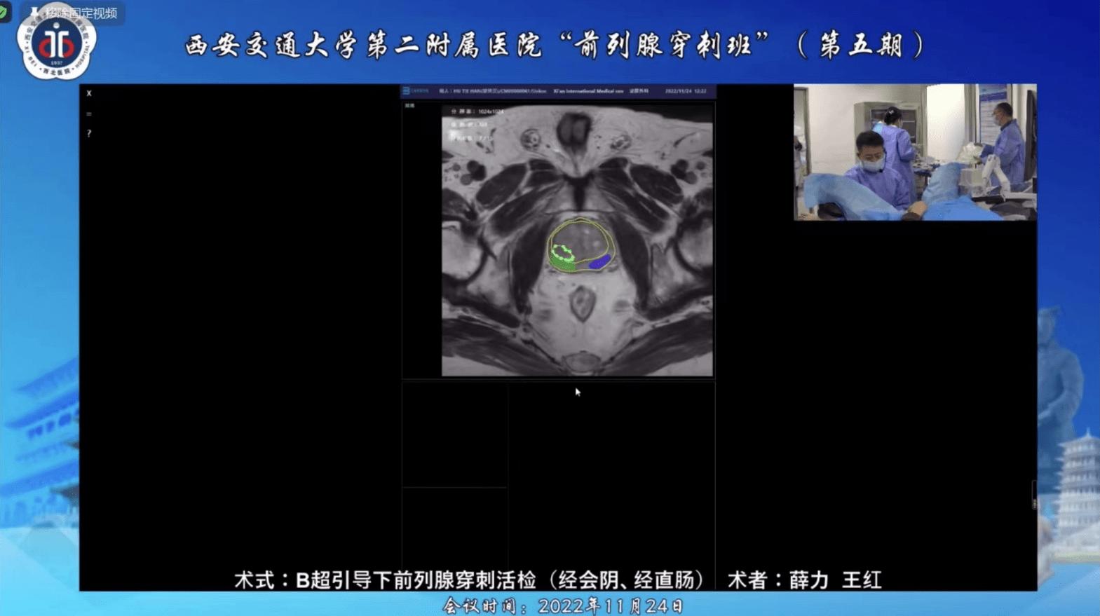 新技术赋能西安交通大学第二附属医院前列腺精准靶向穿刺新突破