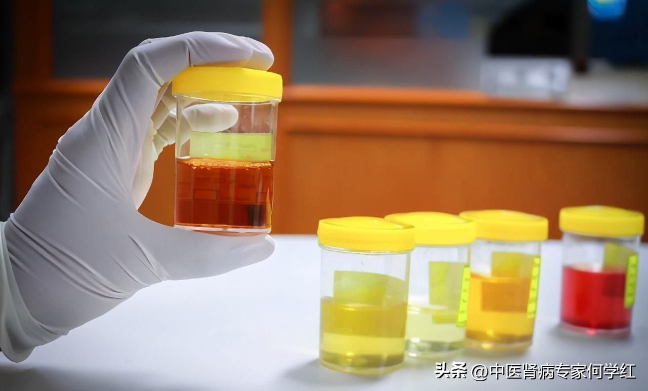 肌酐131肾功能损坏什么程度,肾功能受损怎样恢复