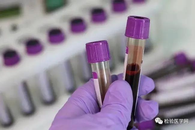 陕西发现棕色熊猫,陕西发现“黄金血”血型