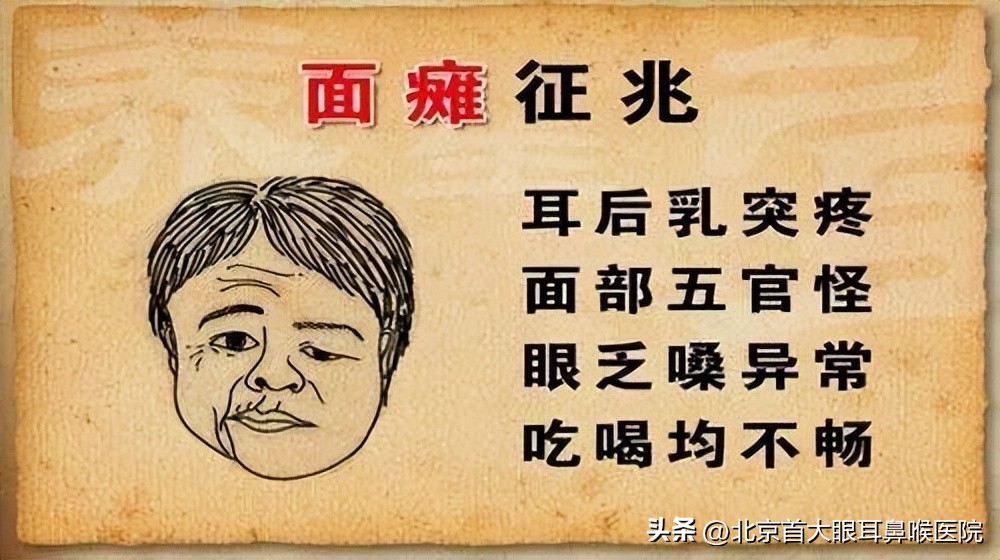 青岛面瘫后遗症谁能治好,面瘫后遗症耳鸣能治好吗