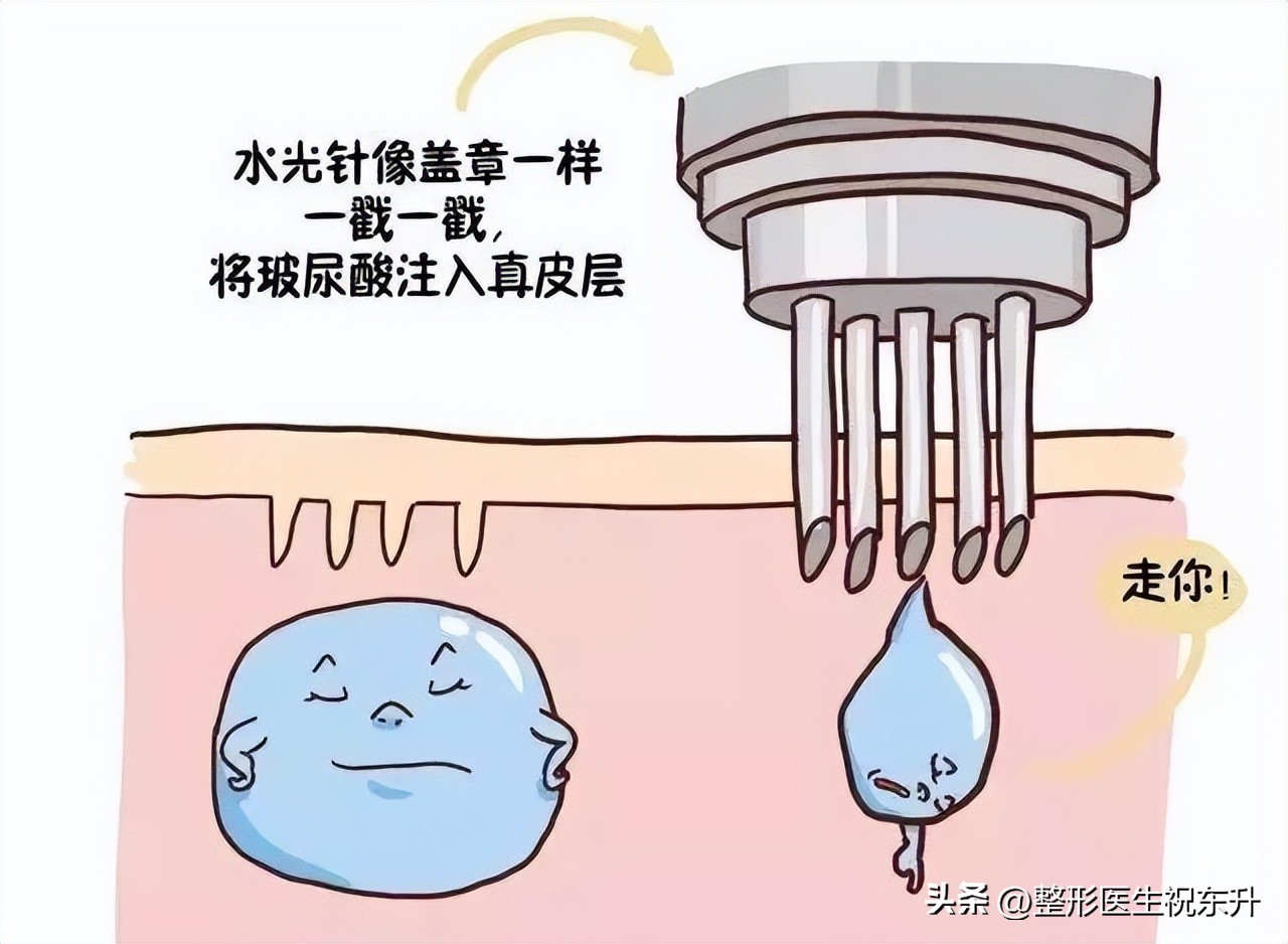 到底有没有必要做拉皮,做拉皮之前你必须要知道的6件事