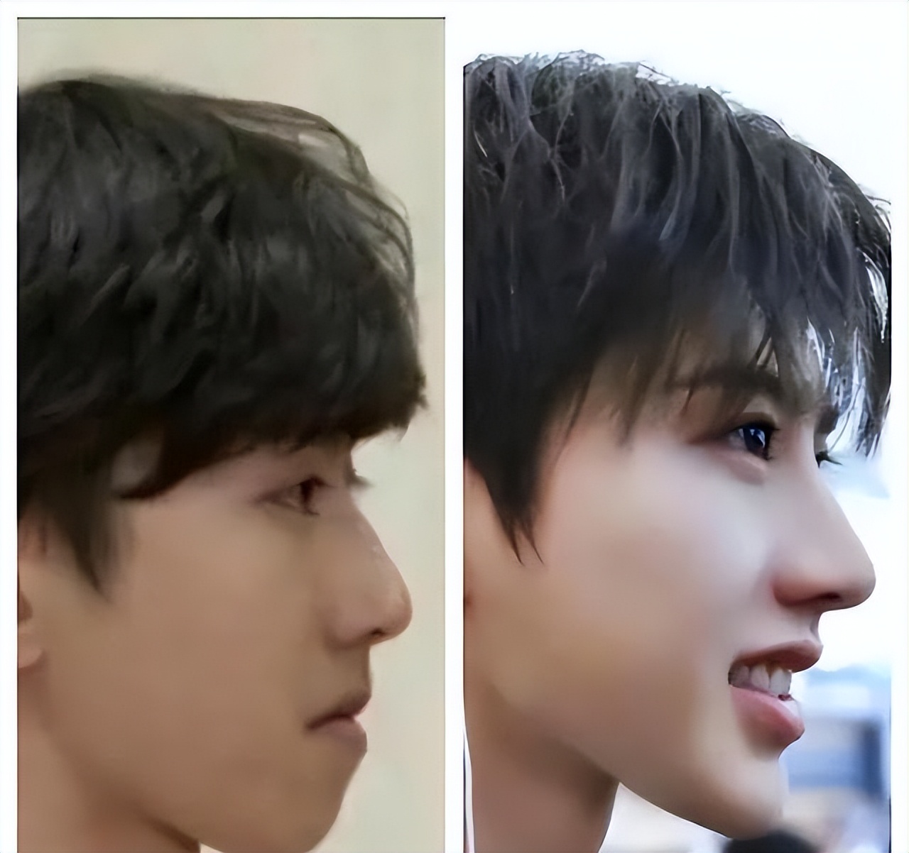 明星整容网红整容,明星整容失败后惨不忍睹的对比