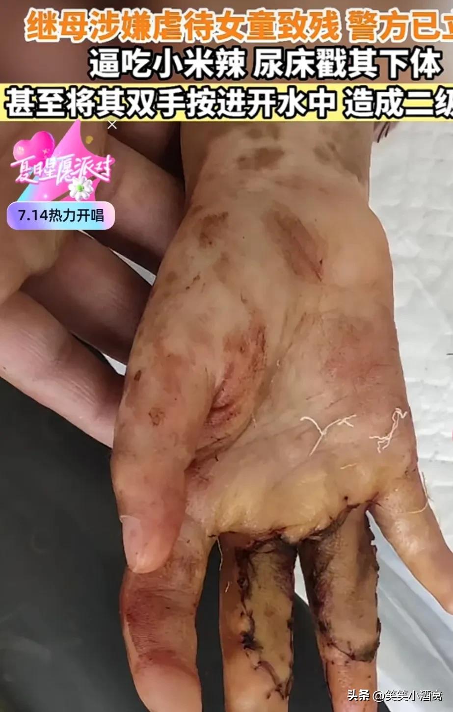 7岁女孩疑被继母虐待2年致死,女孩遭继母虐待全身多处伤痕累累