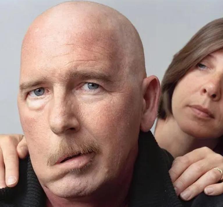 有脑梗前兆如何预防脑梗发生,脑梗会出现什么症状怎样预防脑梗