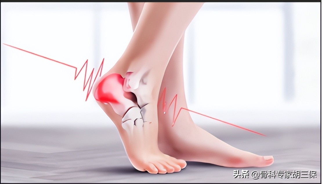 跟腱断裂手术修复动画,什么运动跟腱断裂最多