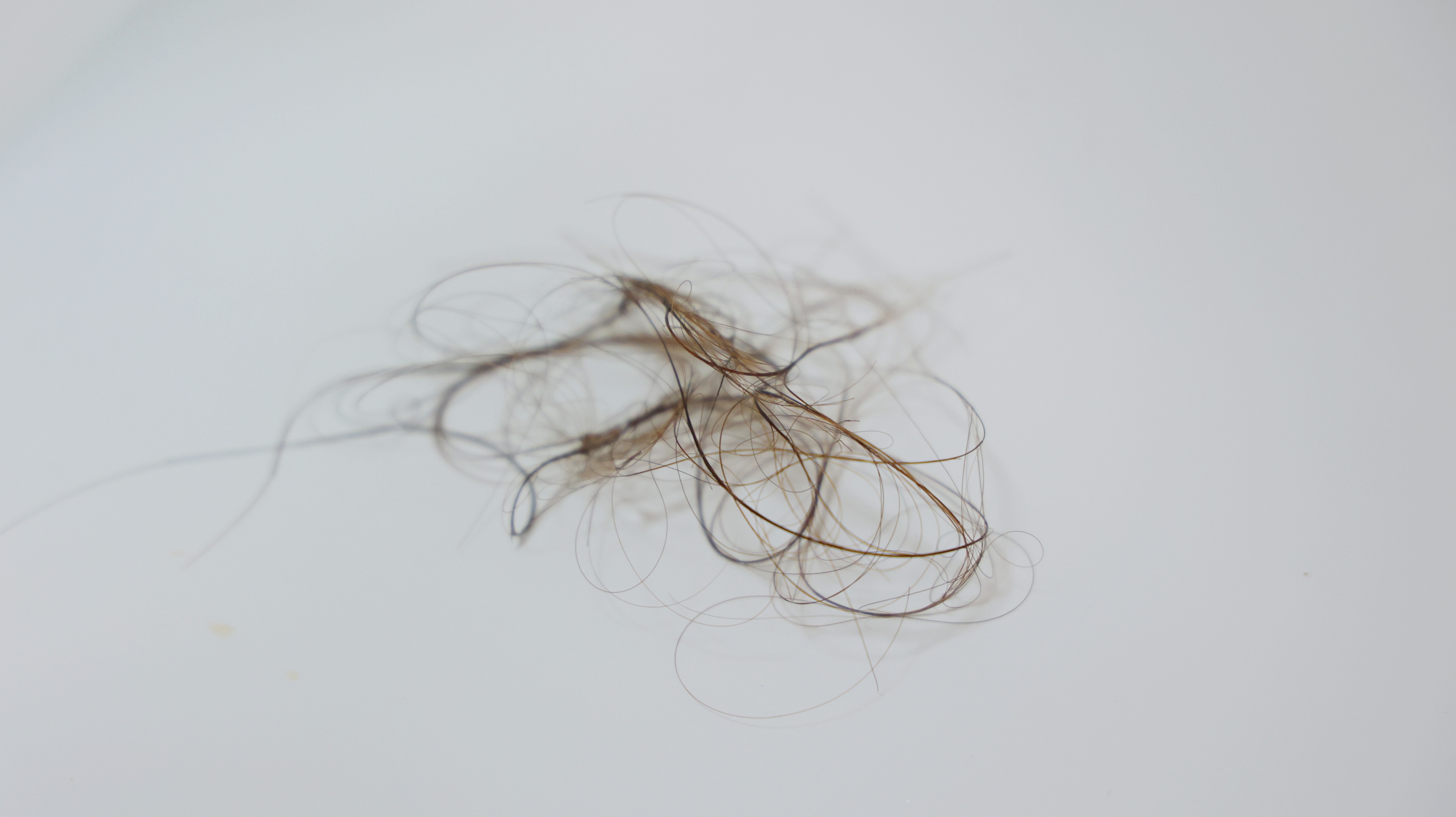 造成脱发的5个原因你知道吗,导致脱发的罪魁祸首你都了解