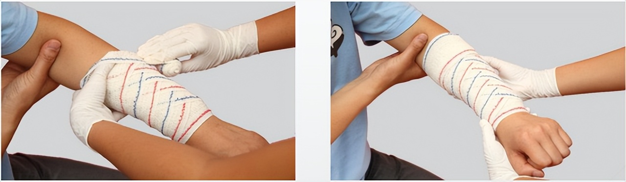 外伤出血的现场包扎技术,外伤出血如何清创包扎