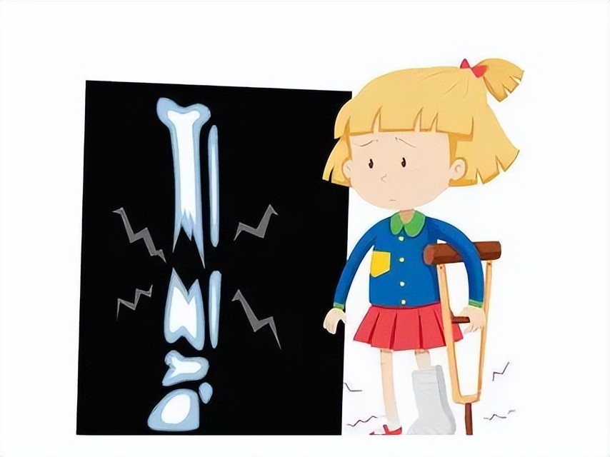 孩子骨折了想保守治疗怎么办,孩子在上学时候骨折了怎么办