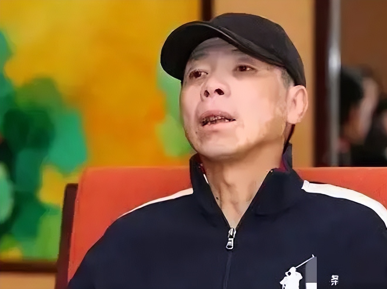 白癜风冯小刚症状,冯小刚谈不治白癜风的原因