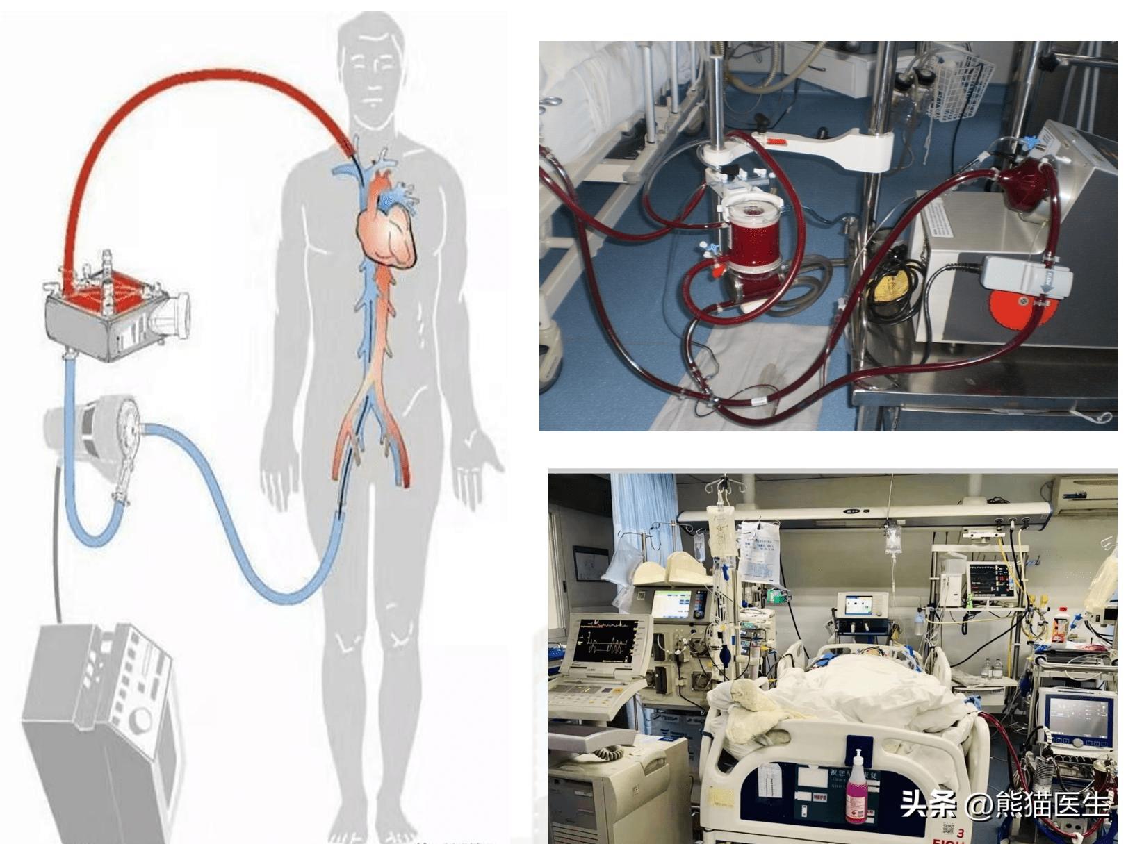 男子患腿疾难治愈,男子腿疼二十多天