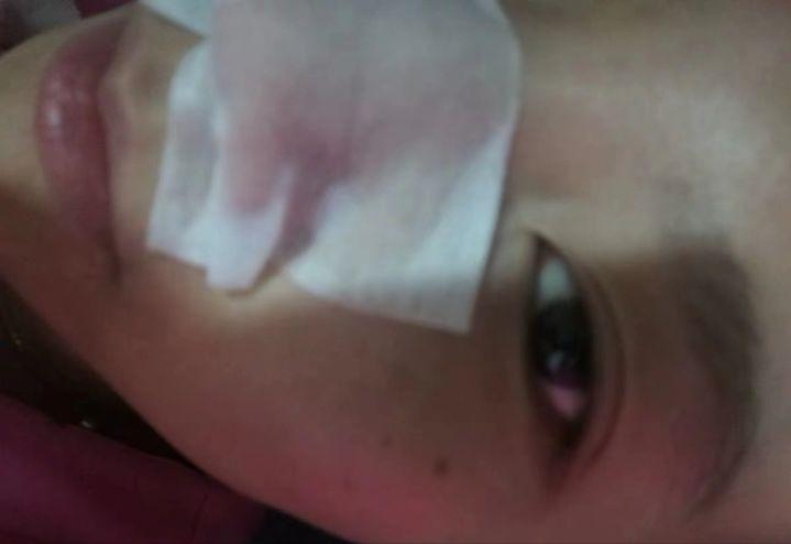 鼻子上有白白的小点可以挤吗,鼻子上黑黑的小点点怎么去除