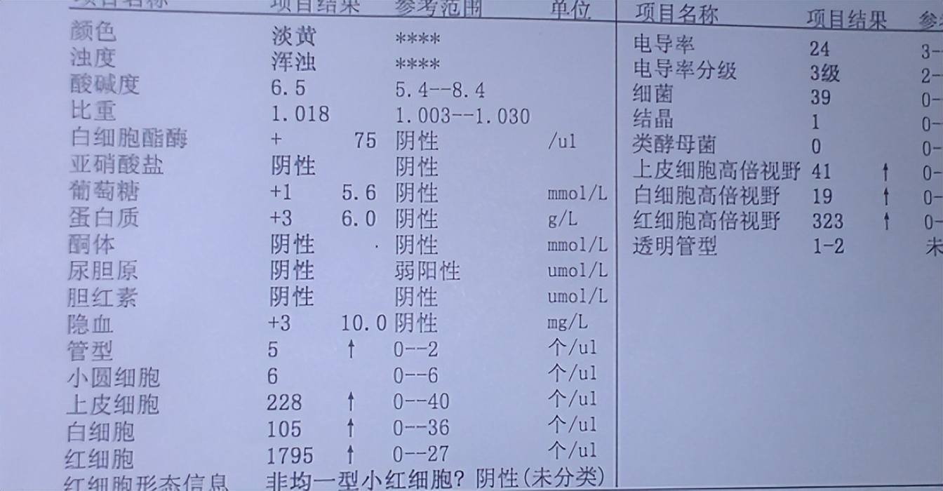 紫癜病友康复历程,紫癜肾炎复发了怎么办