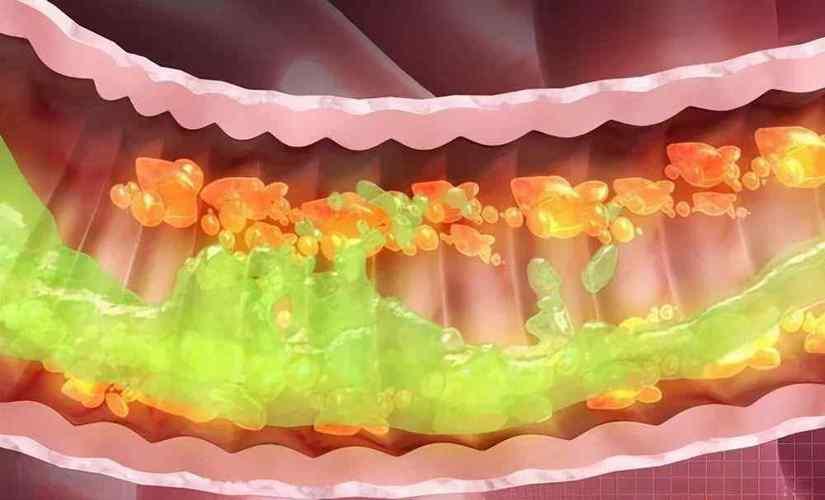人体六公斤宿便怎么排,如何排出体内黑色的宿便