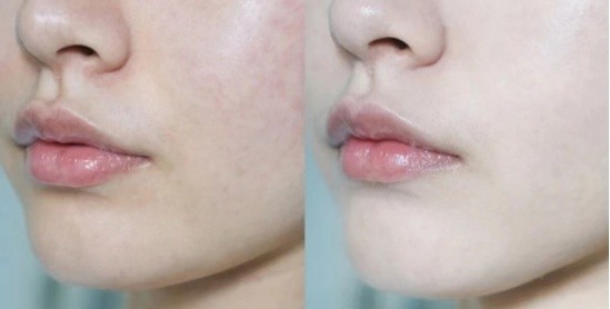 好用的孕妈化妆品推荐,谁推荐一下好用的护肤品