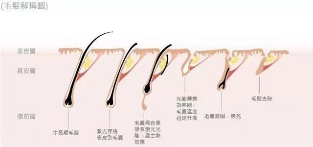 脱毛仪真的有必要买吗,家用脱毛仪那么多真的都值得买吗