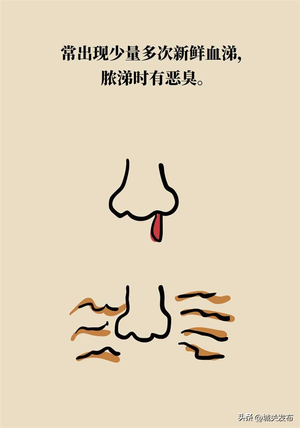 鼻子发霉怎么办,鼻子里因为异物发臭用什么药处理