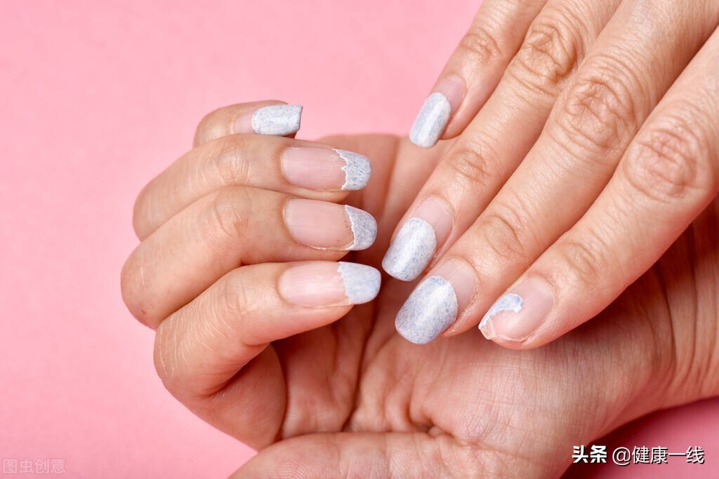 啃指甲手指起倒刺怎么回事,咬指甲手指头有倒刺怎么办