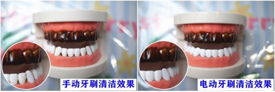 电动牙刷的危害弊端,到底是普通牙刷好还是电动牙刷好